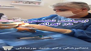 دندانپزشکی تخصصی اقساطی در تهران مطب دکتر پورصادقی