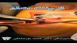 دندانپزشکی تخصصی شبانه در کلینیک دکتر حمید پورصادقی