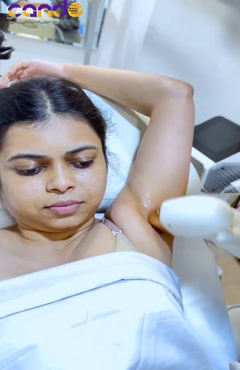 دستگاه لیزر تیتانیوم بهترین دستگاه لیزر برای موهای ضخیم 