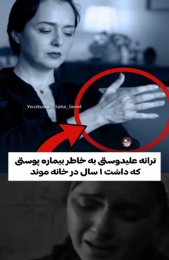 بیماری پوستی ترانه علیدوستی همه را شوکه کرد