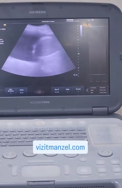 درمان آب آوردن ریه توسط دکتر بهرامی فر 