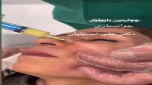 تزریق ژل و جوانسازی پوست با دستگاه پزشکی Bio Filler Maker