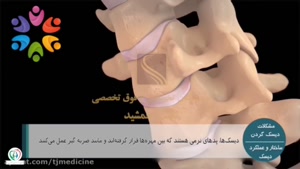 غرامت دیسک گردن در سربازی
