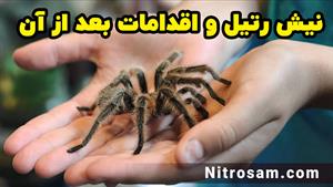 سم نابودی رتیل بزرگ - بهترین سم رتیل کش
