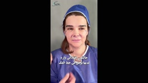 جراحی لیفت دیپ پلین صورت و گردن | چند سال جوونتر شدند؟