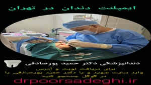 ایمپلنت دندان آقای ملک زاده در دندانپزشکی دکتر حمید پورصادقی