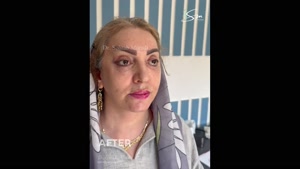 جراحة شد الوجه والرقبة