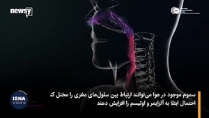 روز «طوفان در مغز» به دلیل آلودگی هوا 