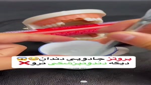 پروتز دندان جادوئی 