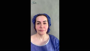 لیفت عمقی صورت و گردن و عمل بینی