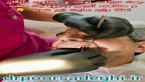 اینپلنت دندان در دندانپزشکی دکتر حمید پور صادقی