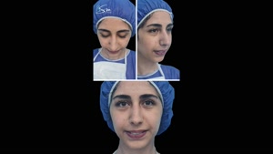جراحة تجميل الذقن وتجميل الأنف