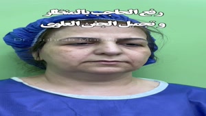 رفع الحاجب بالمنظار وجراحة الجفن العلوی