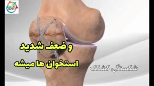 معافیت پزشکی پوکی استخوان