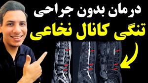 درمان تنگی کانال نخاع بدون جراحی