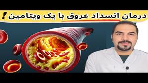 درمان انسداد عروق با ویتامین K و جلوگیری از سکته