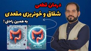 درمان خانگی بواسیر و شقاق مقعدی / درمان سریع و قطعی بواسیر