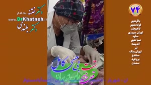 ختنه بدون درد نوزاد استاد دکتر بلندی - فیلم واقعی