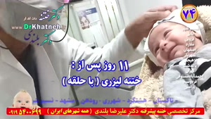 دکتر بلندی ختنه کرج
