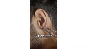 این گوش مال کیه ؟ 😁