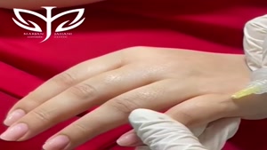 از بین بردن چروک های پشت دست با دستگاه پزشکی Carboxy Therapy