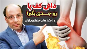 درمان داغی کف پا و علت آن