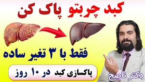 پاکسازی کبد چرب در 10 روز