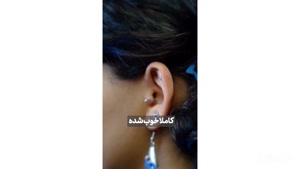 کلوئید ! بعد از یک سال …