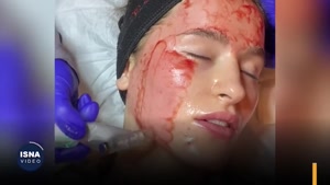 پیامدهای خطرناک سلول درمانی غیرمجاز