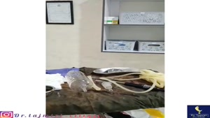 دستگاه پزشکی Lipo Modeling