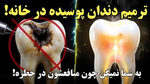 درمان دندان درد در خانه