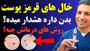 هشدار خال های قرمز بر روی بدن 