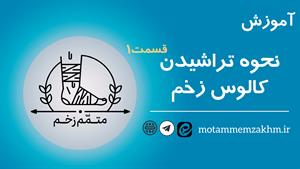 آموزش نحوه تراشیدن کالوس 1 (متمم_زخم) 