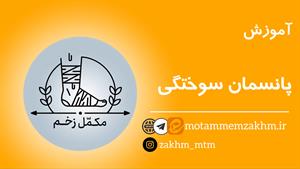 آموزش پانسمان سوختگی (مکمل زخم)
