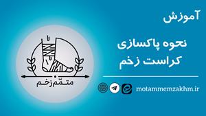 آموزش نحوه پاکسازی کراست زخم (متمم_زخم)