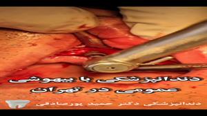 دندانپزشکی با بیهوشی عمومی در تهران توسط دکتر حمید پورصادقی