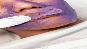 فیشیال صورت