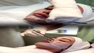 فیشیال پوست