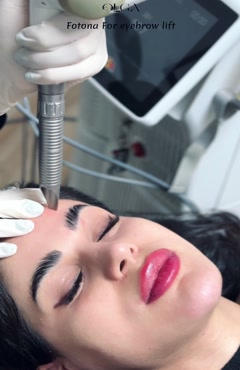 تزریق جوانساز