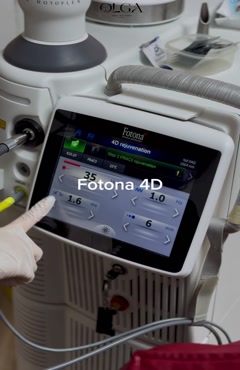 لیزر فوتونا