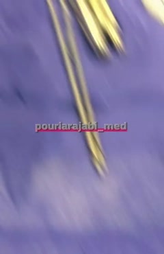 نصب و آموزش تخصصی دستگاه لایپو مدلینگ (ساکشن چربی)