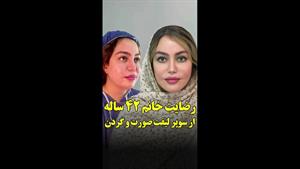 رضایت از سوپر لیفت صورت و گردن با زیبایی طبیعی