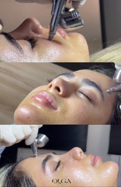 درماکسی تراپی