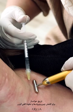 جوانسازی گردن