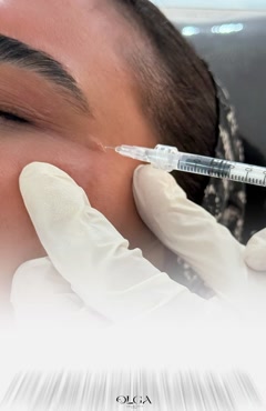 تزریق بوتاکس