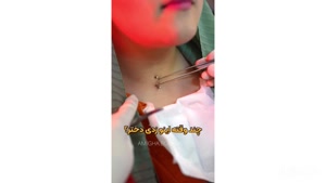 اشتباه یک پیرسینگ‌کار