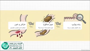 خون در مدفوع و سرطان روده بزرگ؛ clinicdarman.com