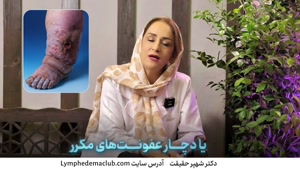 چرا بعضی افراد دچار لنف ادم نمی شوند؟
