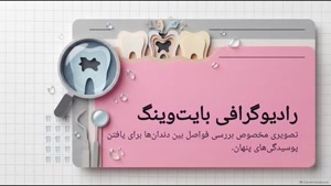 رادیولوژی دندان سعادت آباد برای ایمپلنت چه کاربردی دارد؟
