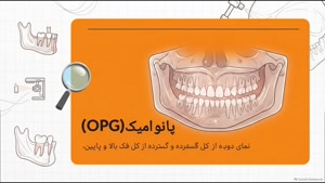 چرا انتخاب مرکز مناسب برای رادیولوژی فک و صورت مهم است؟